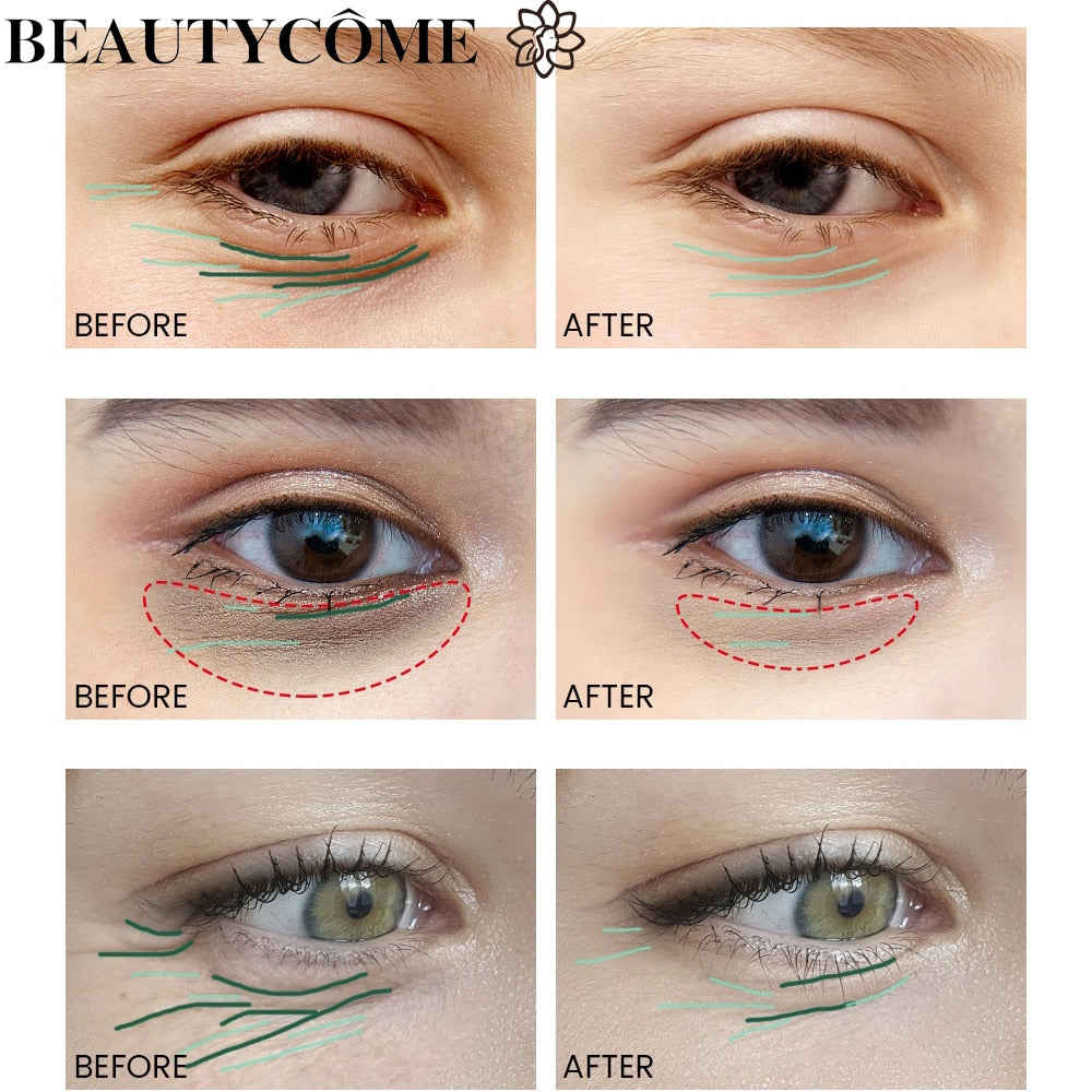 BEAUTYCOME Retinol Face Eye Cream Serum 4PCS/Set - Anti-Aging & Wrinkle Reduction