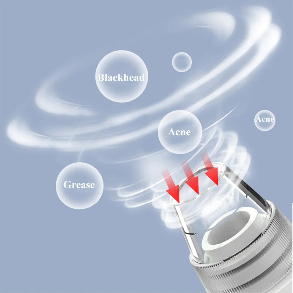Electric Blackhead Remover Pore Cleaner Vacuum with 3 Temperature Levels