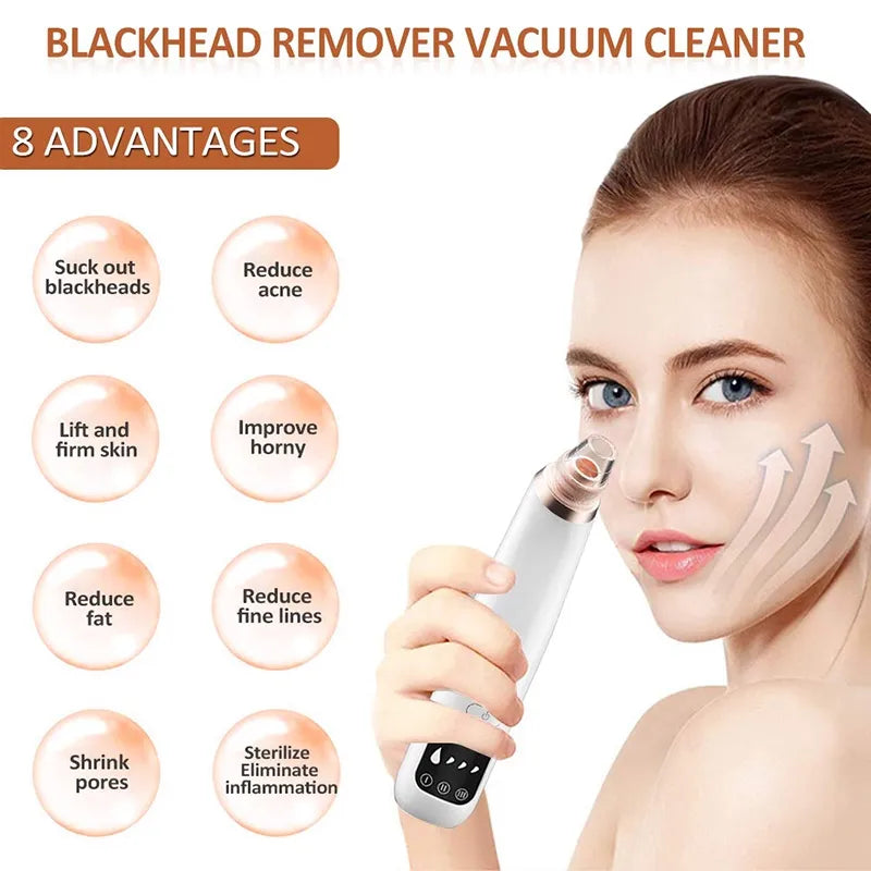 Electric Blackhead Remover Pore Cleaner Vacuum with 3 Temperature Levels