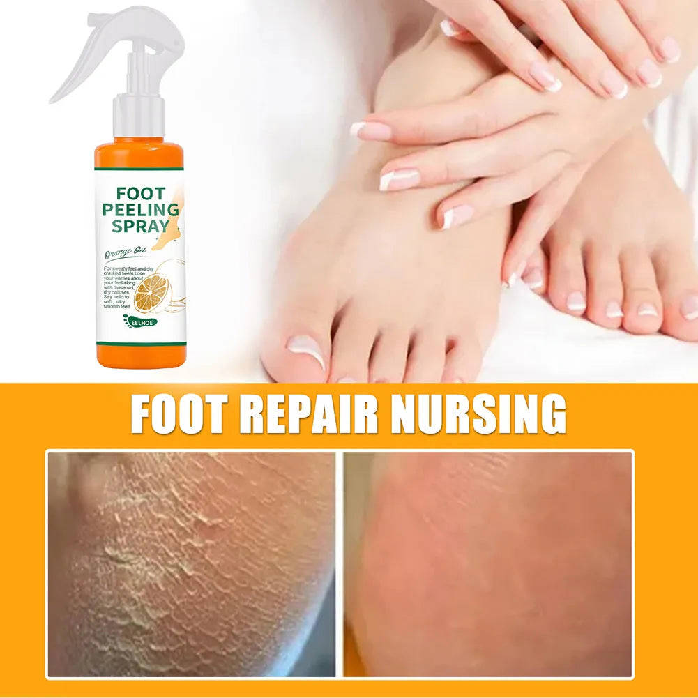 100ml Orange Essential Oil Foot Peeling Spray - Dead Skin Exfoliator & Moisturizer for Pedicure Care