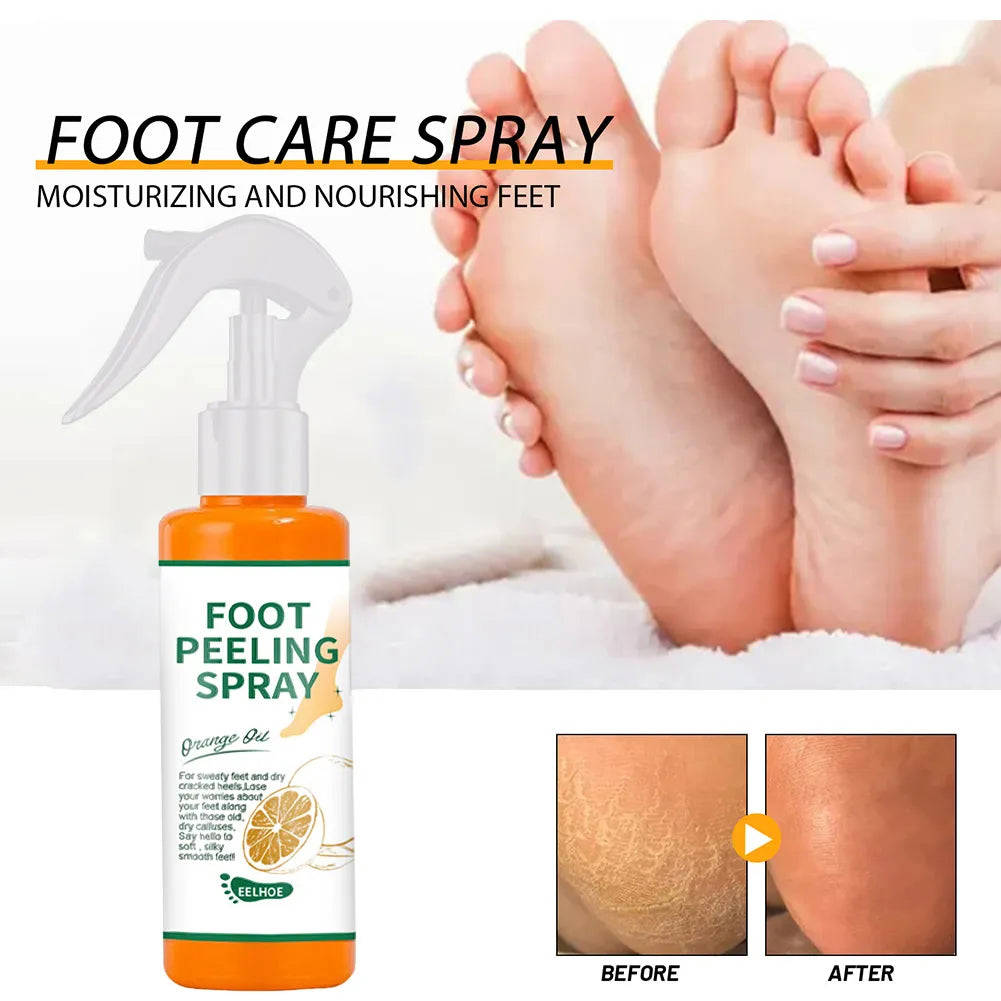 100ml Orange Essential Oil Foot Peeling Spray - Dead Skin Exfoliator & Moisturizer for Pedicure Care