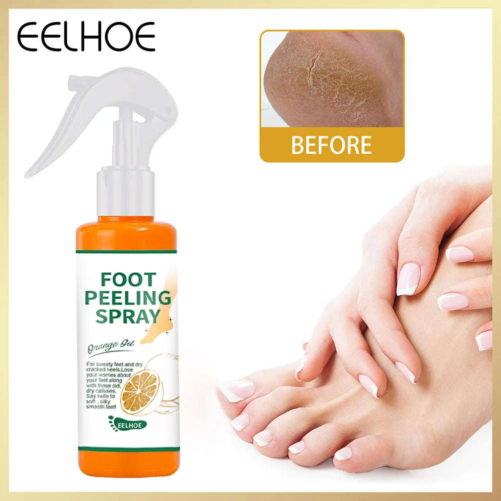 100ml Orange Essential Oil Foot Peeling Spray - Dead Skin Exfoliator & Moisturizer for Pedicure Care