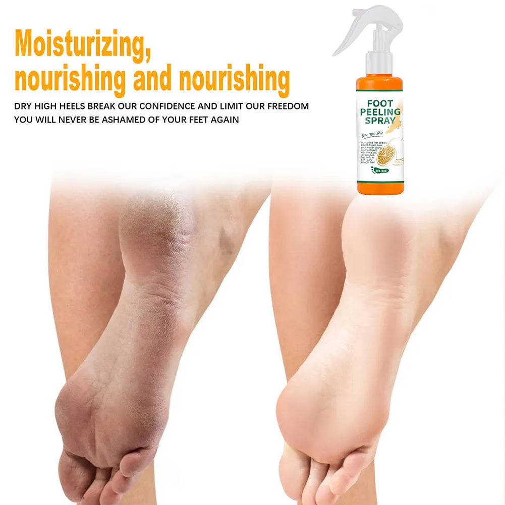 100ml Orange Essential Oil Foot Peeling Spray - Dead Skin Exfoliator & Moisturizer for Pedicure Care
