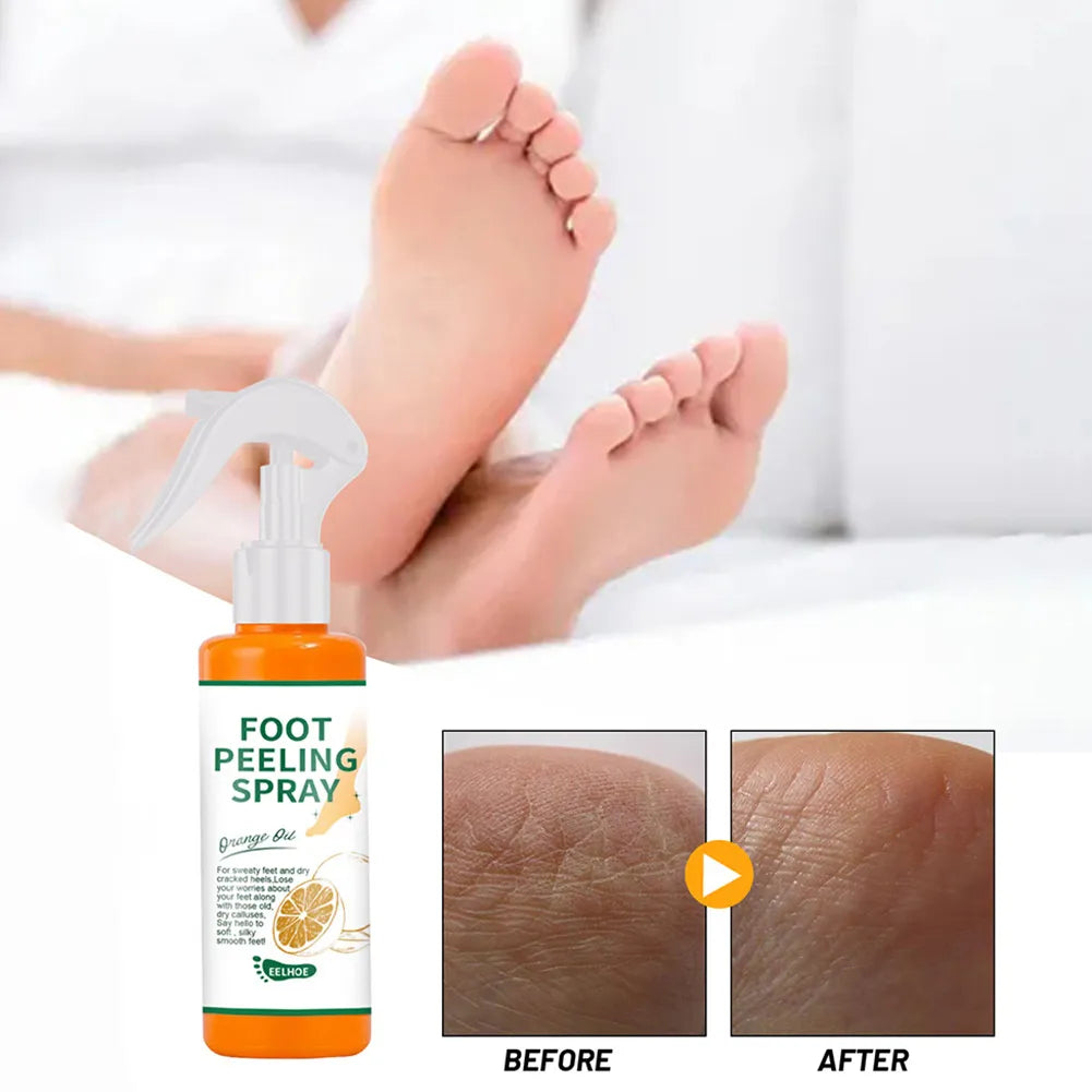 100ml Orange Essential Oil Foot Peeling Spray - Dead Skin Exfoliator & Moisturizer for Pedicure Care