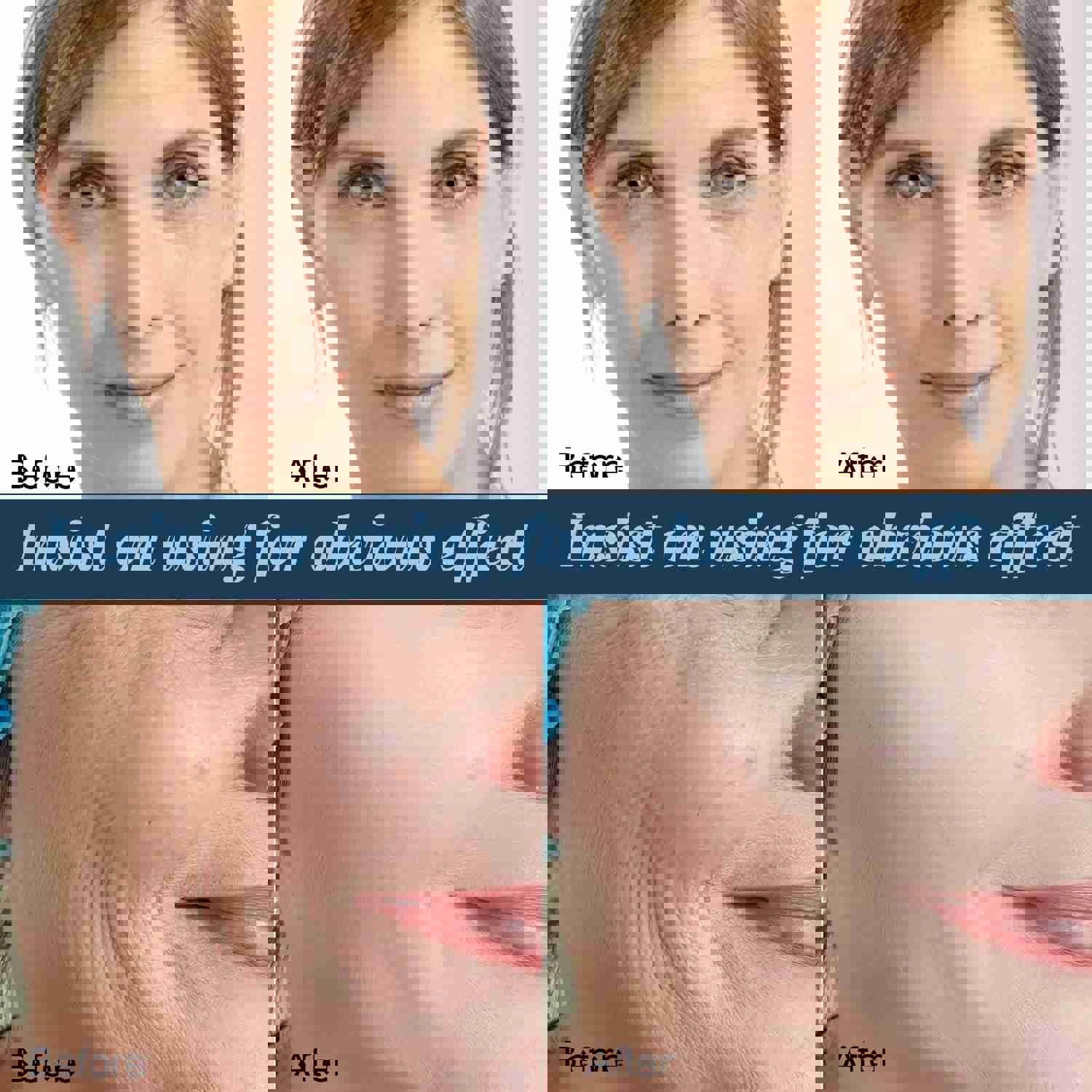 60pcs Gold Protein Line Anti-wrinkle Firming Facial Filler No Needle Absorbable Fade Fine Lines Collagen Thread Anti-Aging Serum