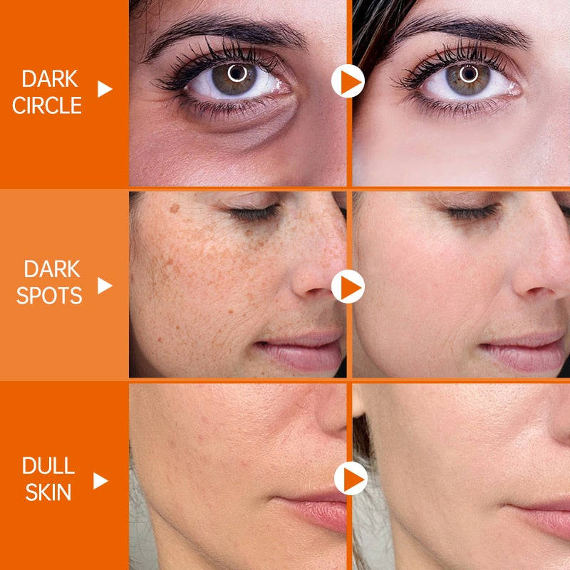 JoyPretty VC Skin Care Set - 5 PCS Whitening & Glowing Facial Kit for Dark Skin