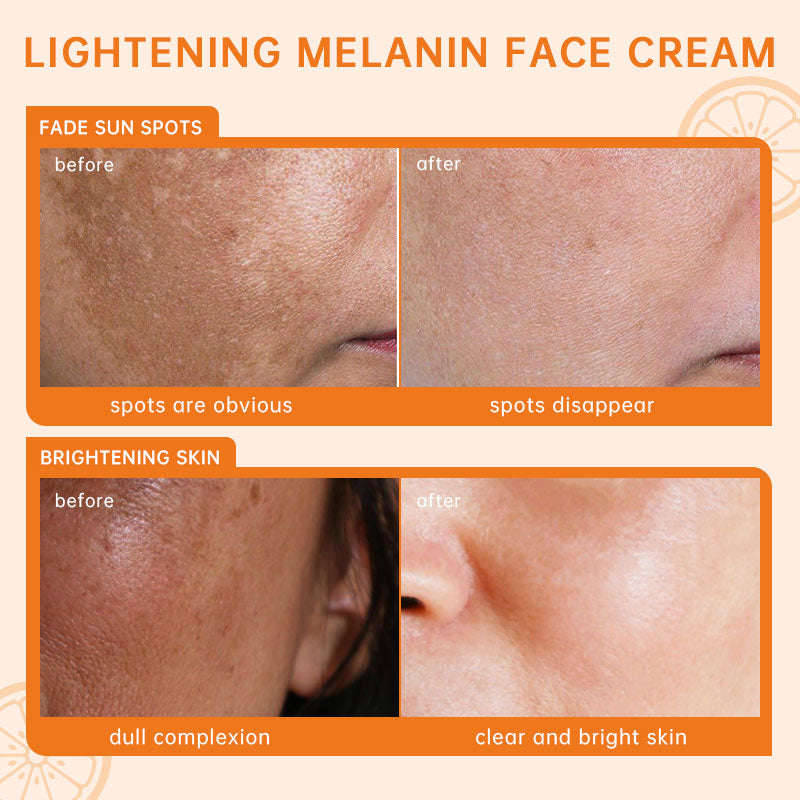 JoyPretty VC Skin Care Set - 5 PCS Whitening & Glowing Facial Kit for Dark Skin