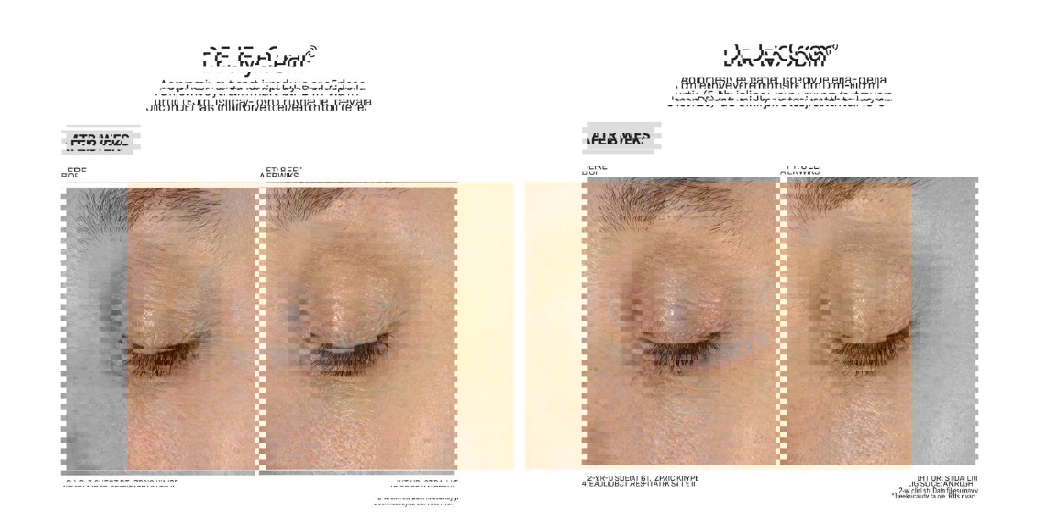 Revision Skincare D·E·J Eye Cream® (0.5 oz Pump)