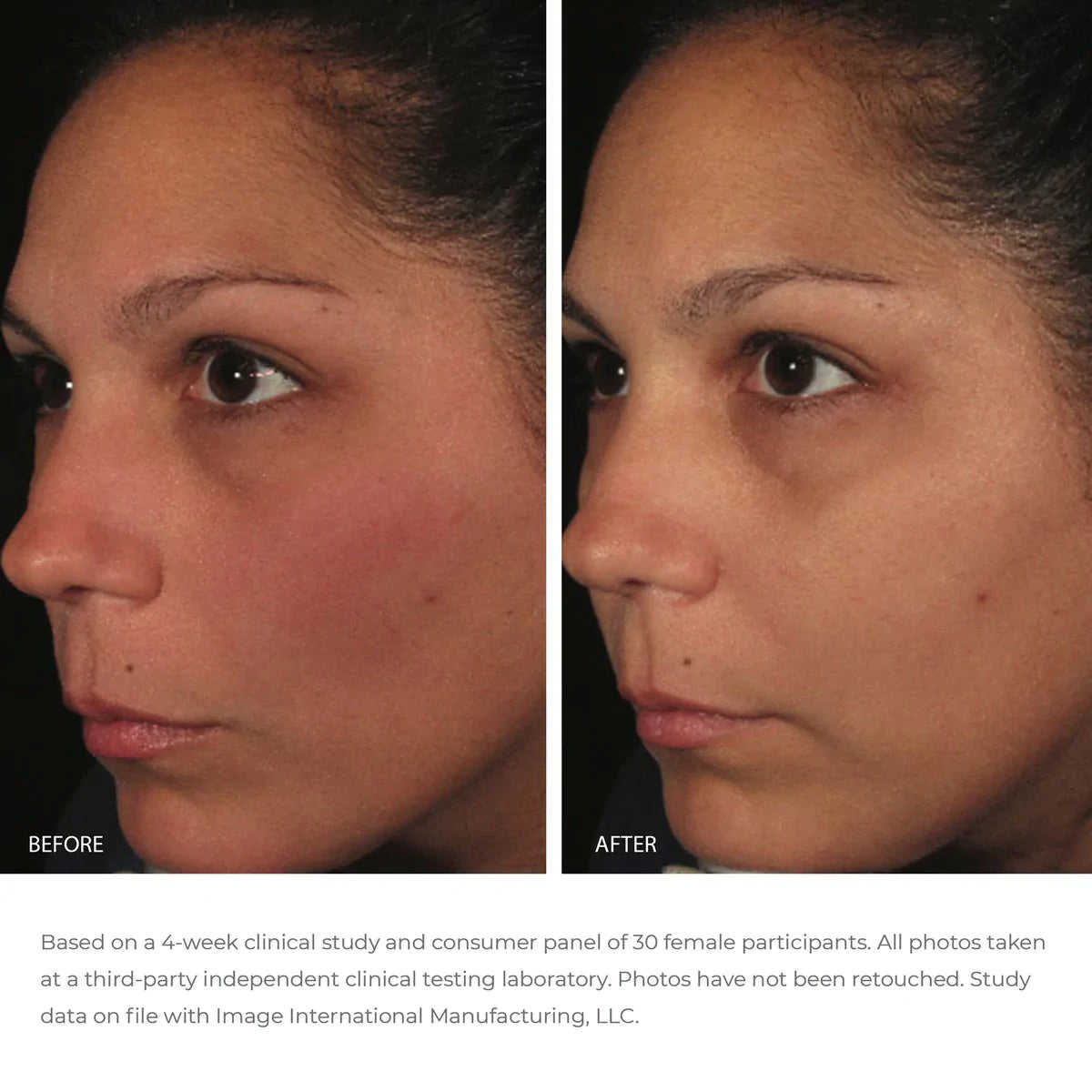 Image Skincare ORMEDIC Balancing Anti-Oxidant Serum