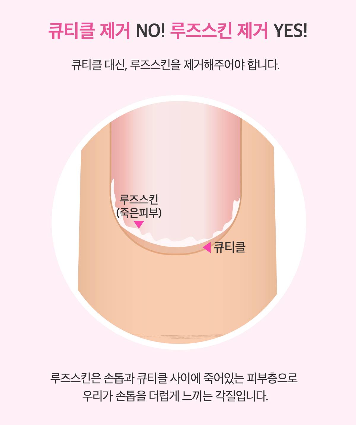 Dr.Wonder Poket Cuticle Remover Beauty Nailcare Tool