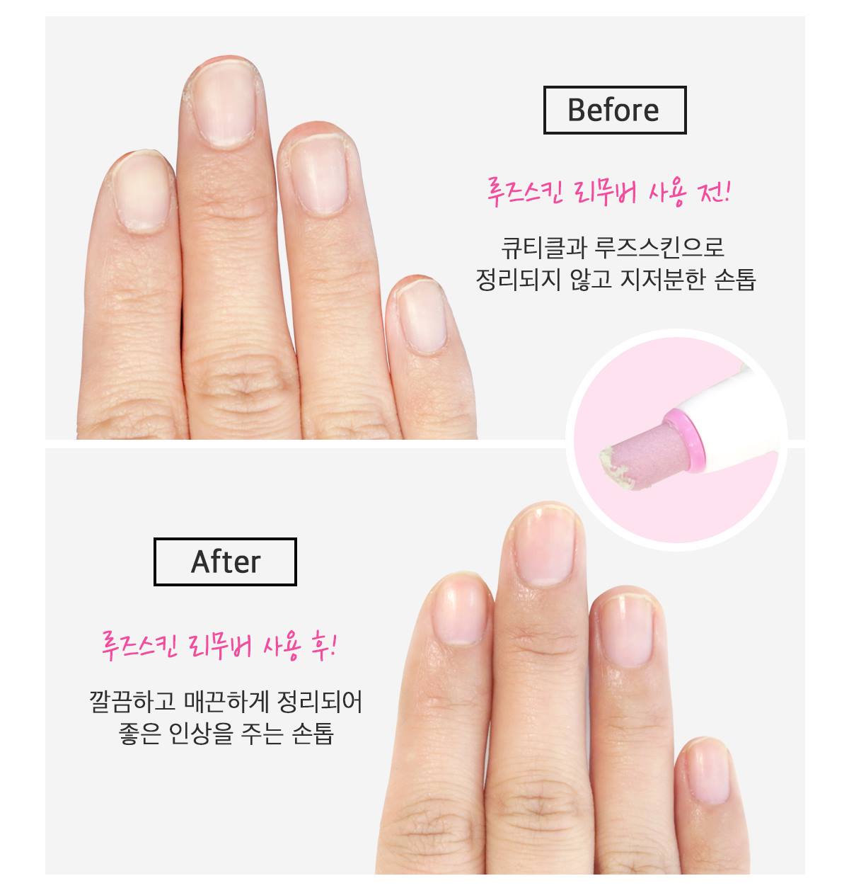 Dr.Wonder Poket Cuticle Remover Beauty Nailcare Tool