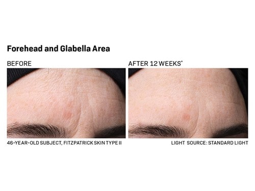 Revision Skincare Revox Line Relaxer Serum with Peptides & Hyaluronic Acid
