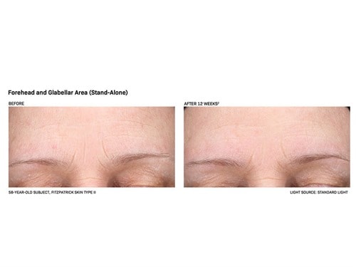 Revision Skincare Revox Line Relaxer Serum with Peptides & Hyaluronic Acid