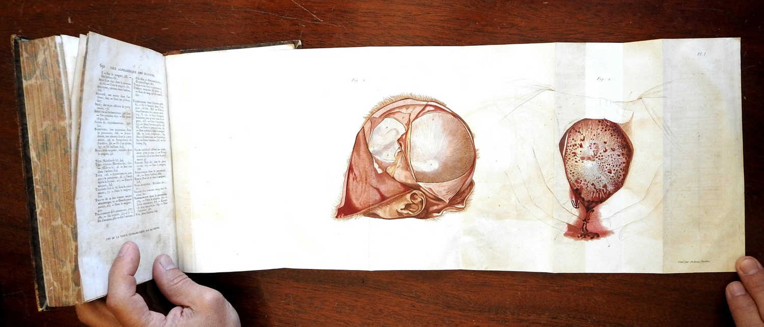 Illnesses of Newborn Children 1868 Valleix French Medical Book with Color Plates