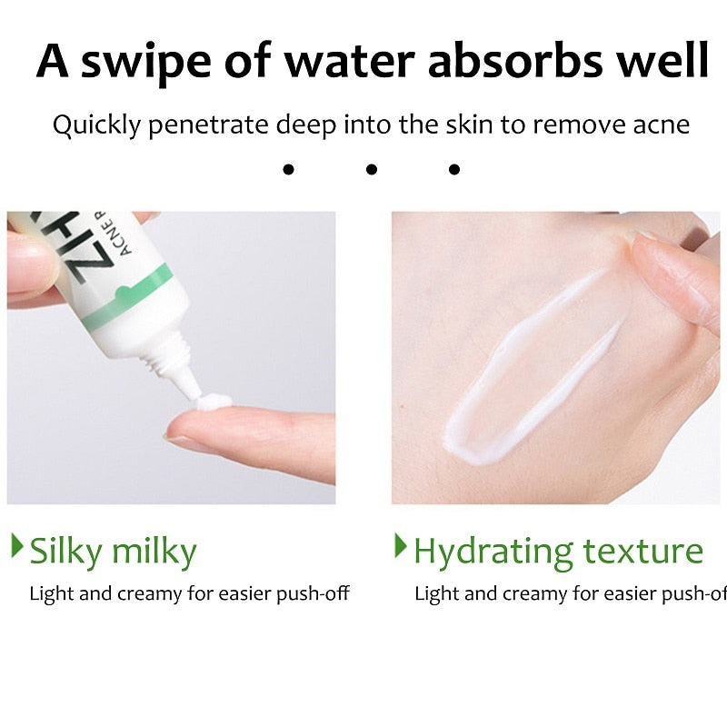 Lanthome Salicylic Acid Acne Cream - Blackhead Removal, Oil Control & Scar Whitening Face Treatment