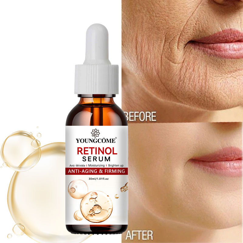 LANBENA Retinol Face Serum - Anti-Aging, Acne Scar Removal & Skin Brightening