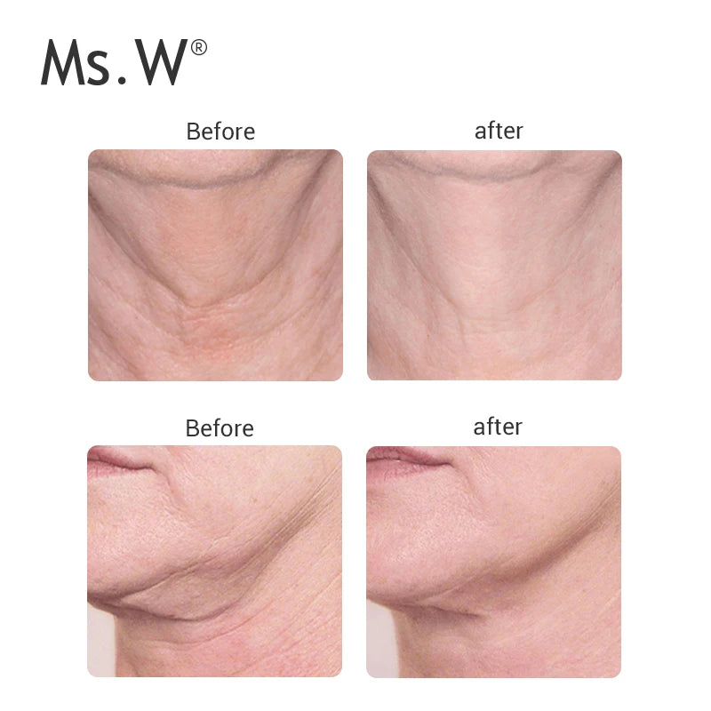 Ms.W New Home-Use 5 in 1 Skin Care Anti-aging Face & Neck Lifting Massager Beauty Tools