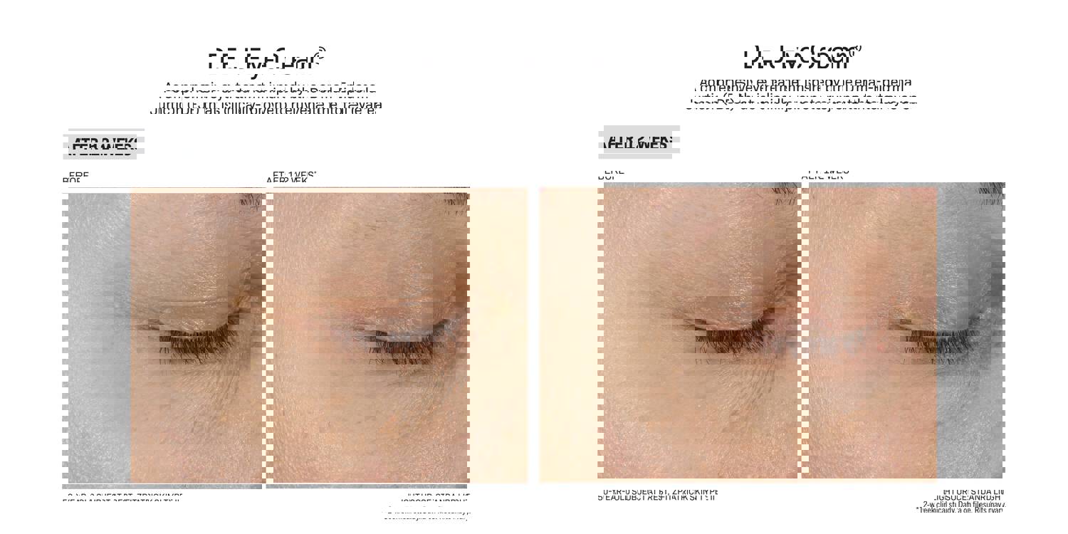 Revision Skincare D·E·J Eye Cream (0.5 oz)