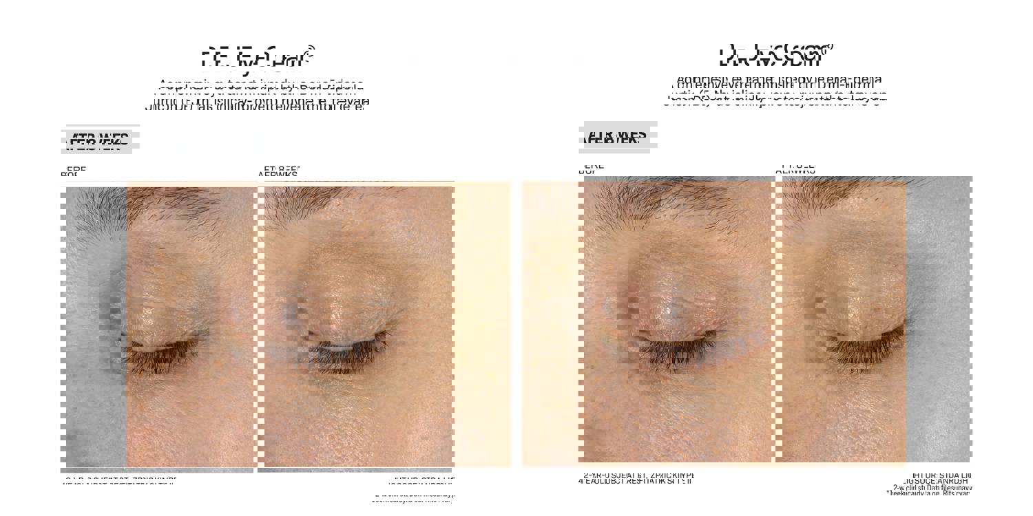 Revision Skincare D·E·J Eye Cream (0.5 oz)