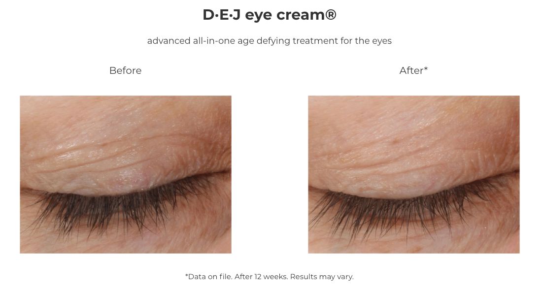 Revision Skincare D·E·J Eye Cream (0.5 oz)