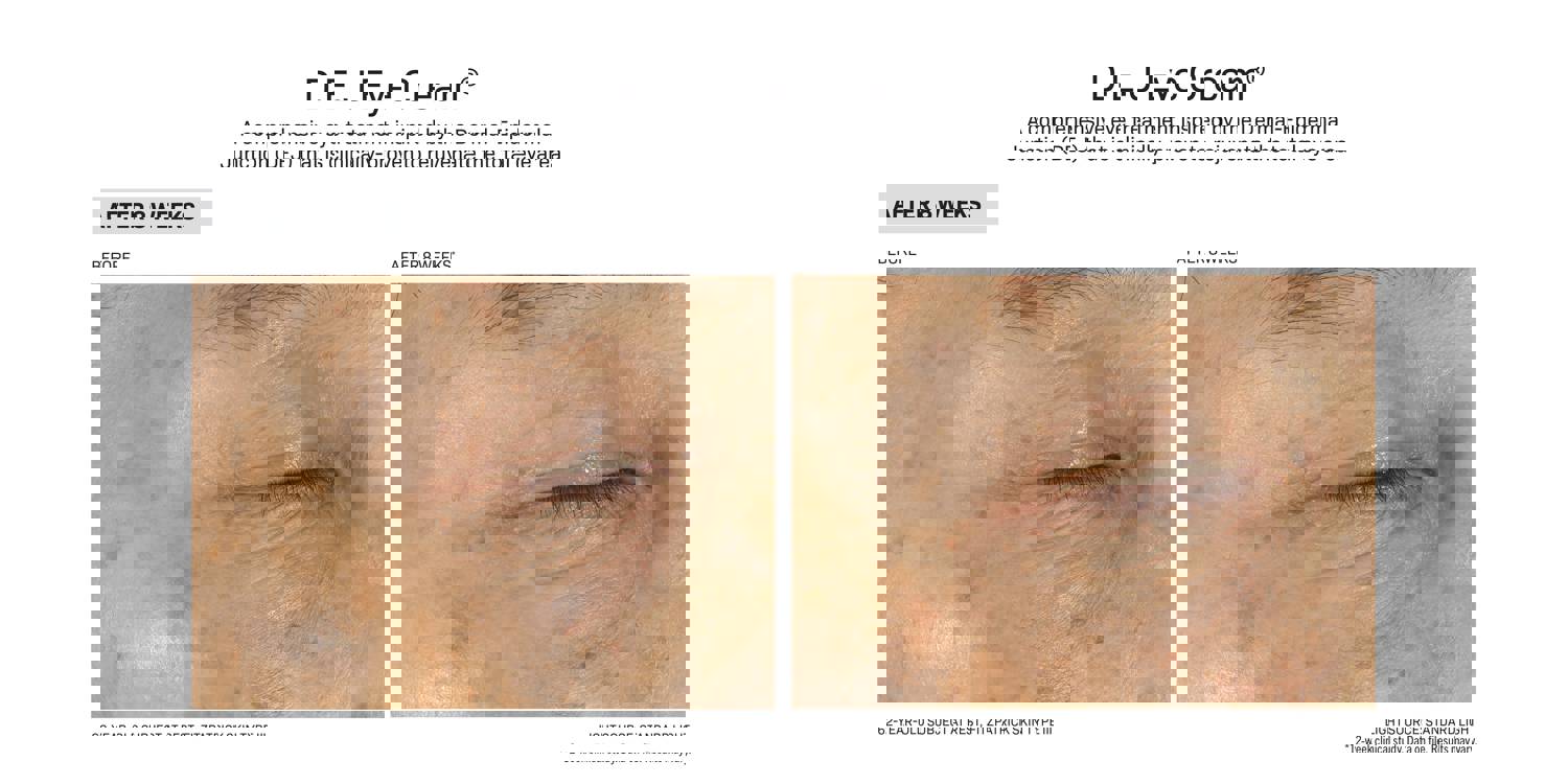 Revision Skincare D·E·J Eye Cream (0.5 oz)