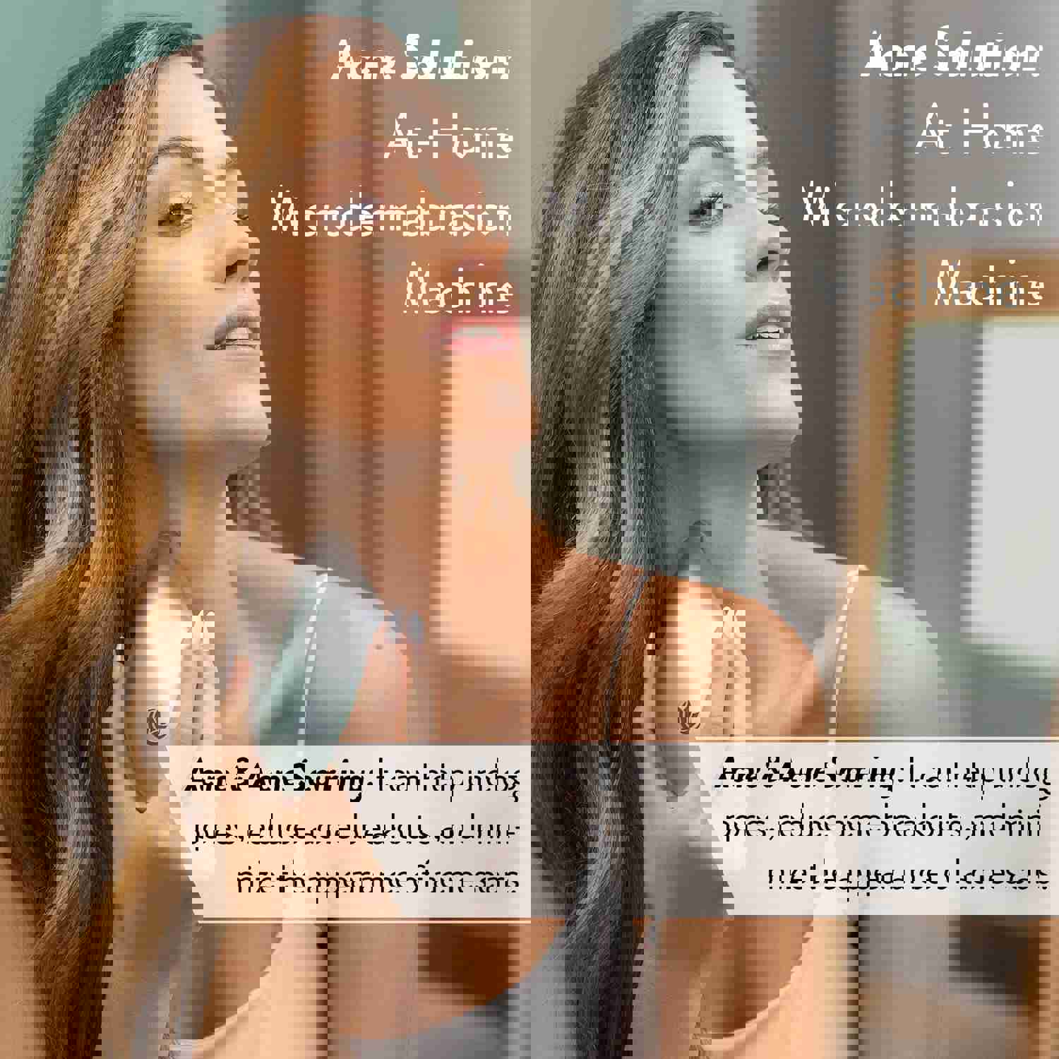 Microderm GLO Diamond Microdermabrasion Essentials Skincare Bundle