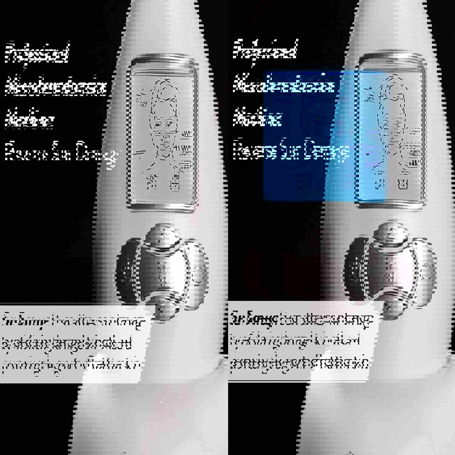 Microderm GLO Diamond Microdermabrasion Essentials Skincare Bundle