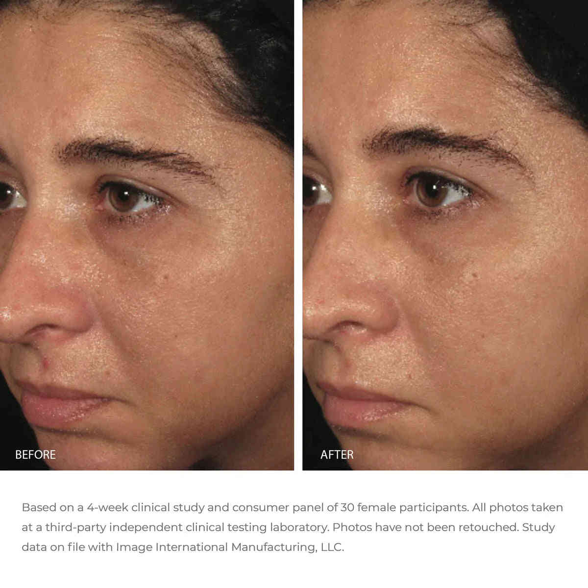 Image Skincare Ormedic Balancing Bio-Peptide Creme