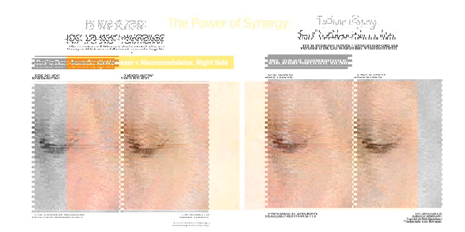 Revision Skincare Revox™ Line Relaxer - Advanced Anti-Wrinkle Serum (1 oz)