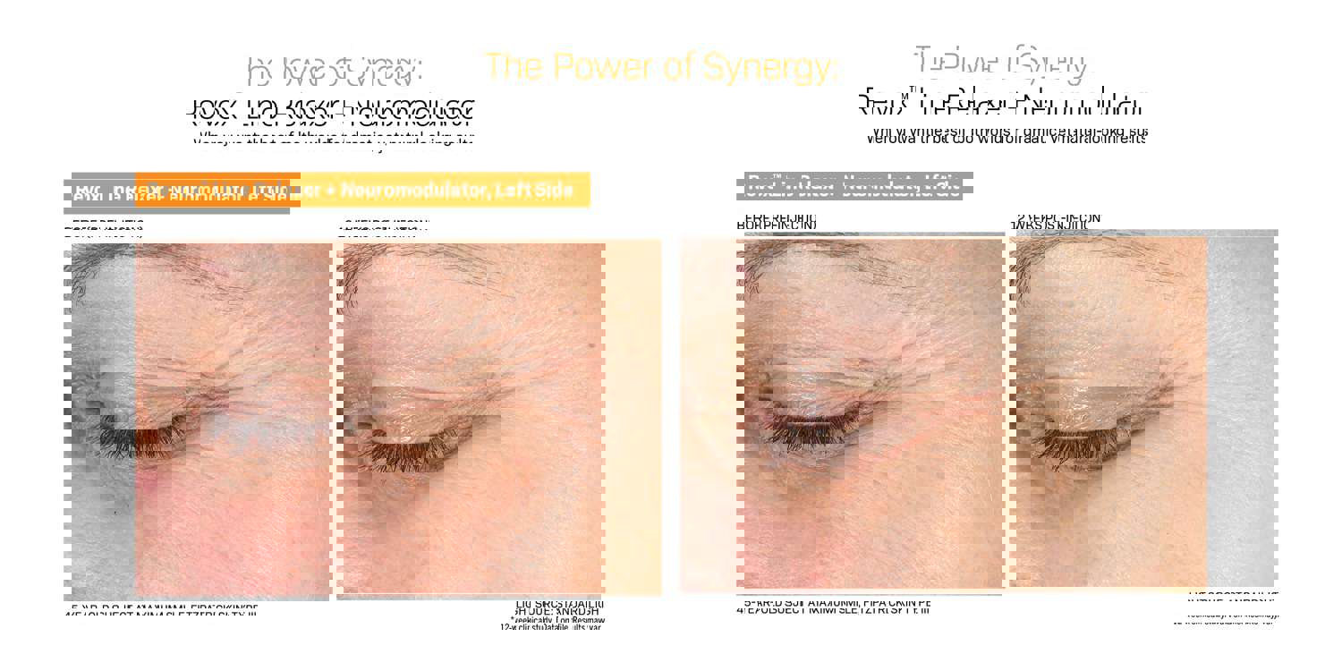 Revision Skincare Revox™ Line Relaxer - Advanced Anti-Wrinkle Serum (1 oz)