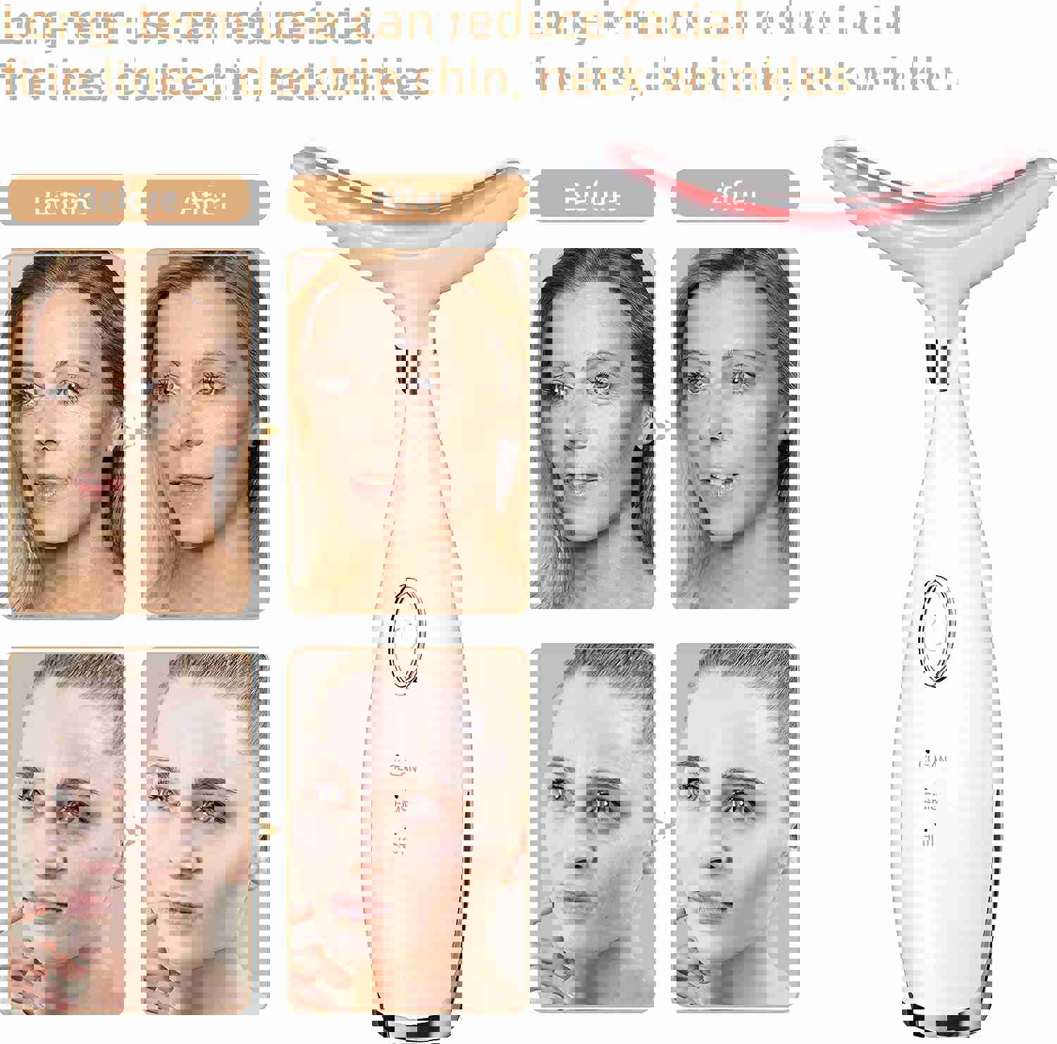 3 Modes Neck Beauty Device Facial Massager for Wrinkle Removal & Face Lift