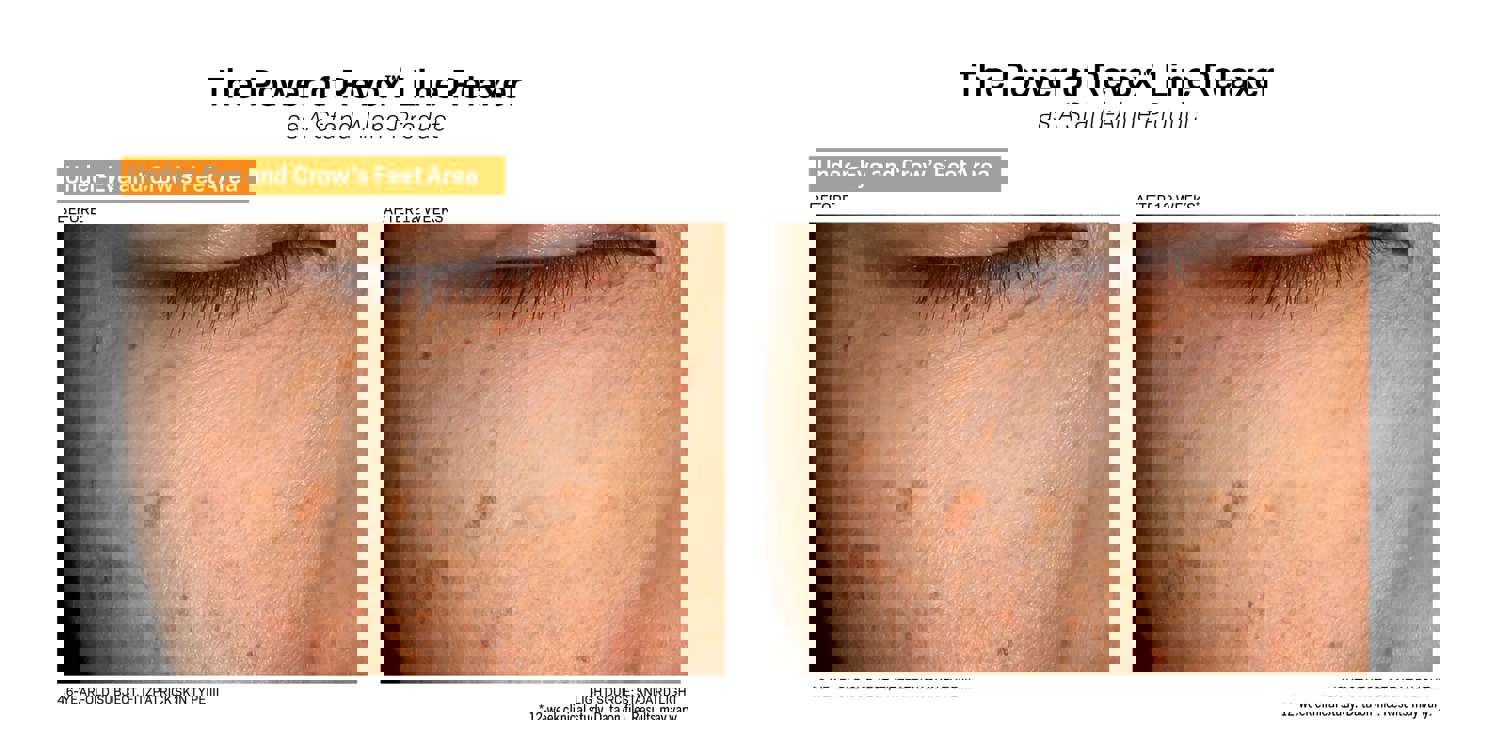 Revision Skincare Revox™ Line Relaxer (0.68 oz)