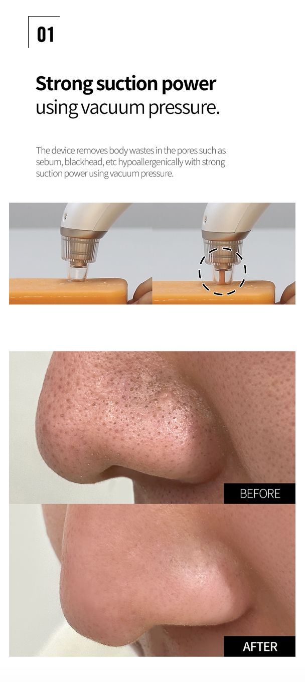 FACE FACTORY BEAUTY SUCTION - Korean Premium Blackhead Remover Vacuum for Pore Sebum Removal