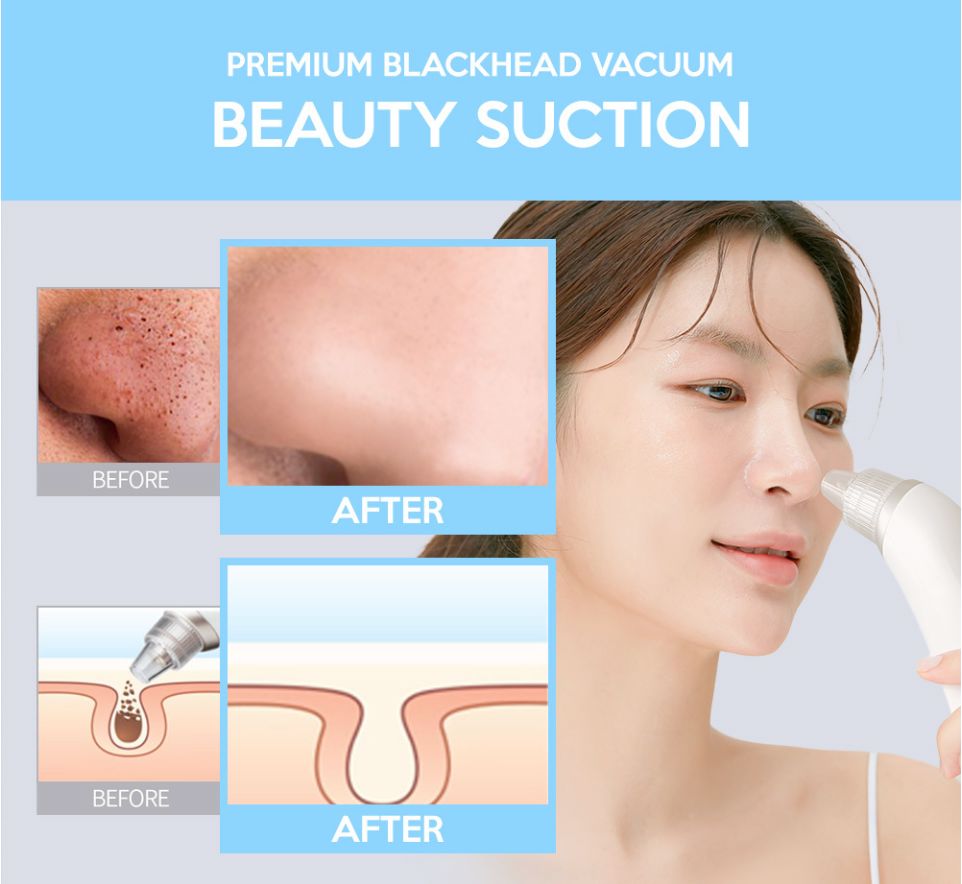 FACE FACTORY BEAUTY SUCTION - Korean Premium Blackhead Remover Vacuum for Pore Sebum Removal