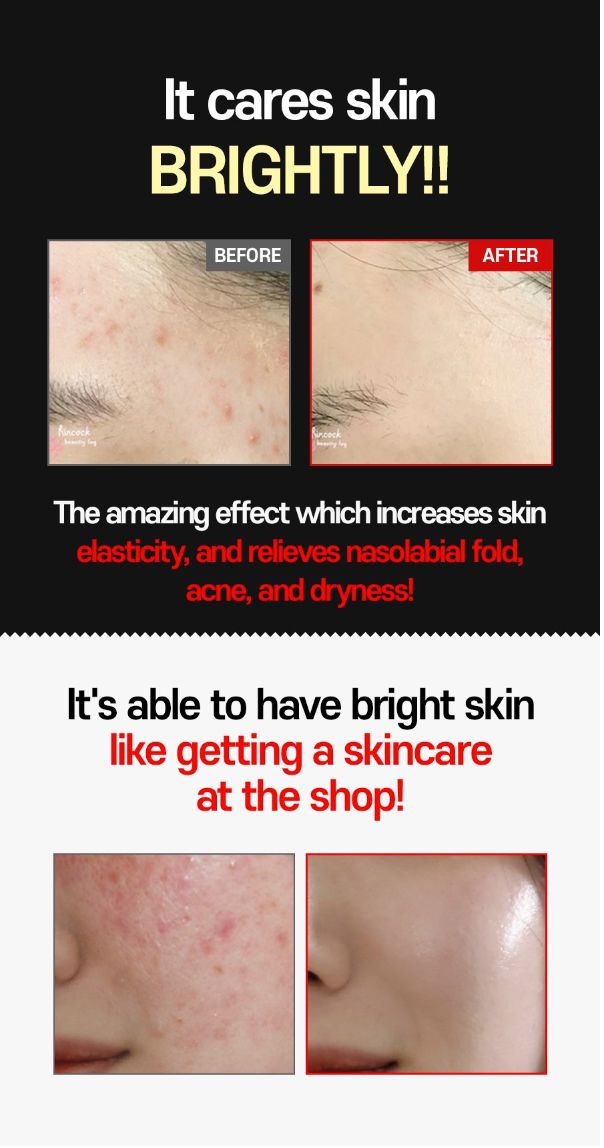 FACE FACTORY BEAUTY SUCTION - Korean Premium Blackhead Remover Vacuum for Pore Sebum Removal