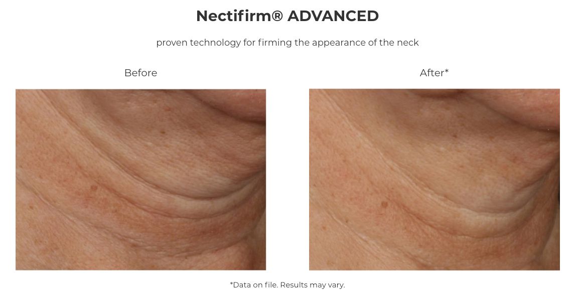 Revision Skincare Nectifirm® ADVANCED Neck Firming Cream (1.7 oz)