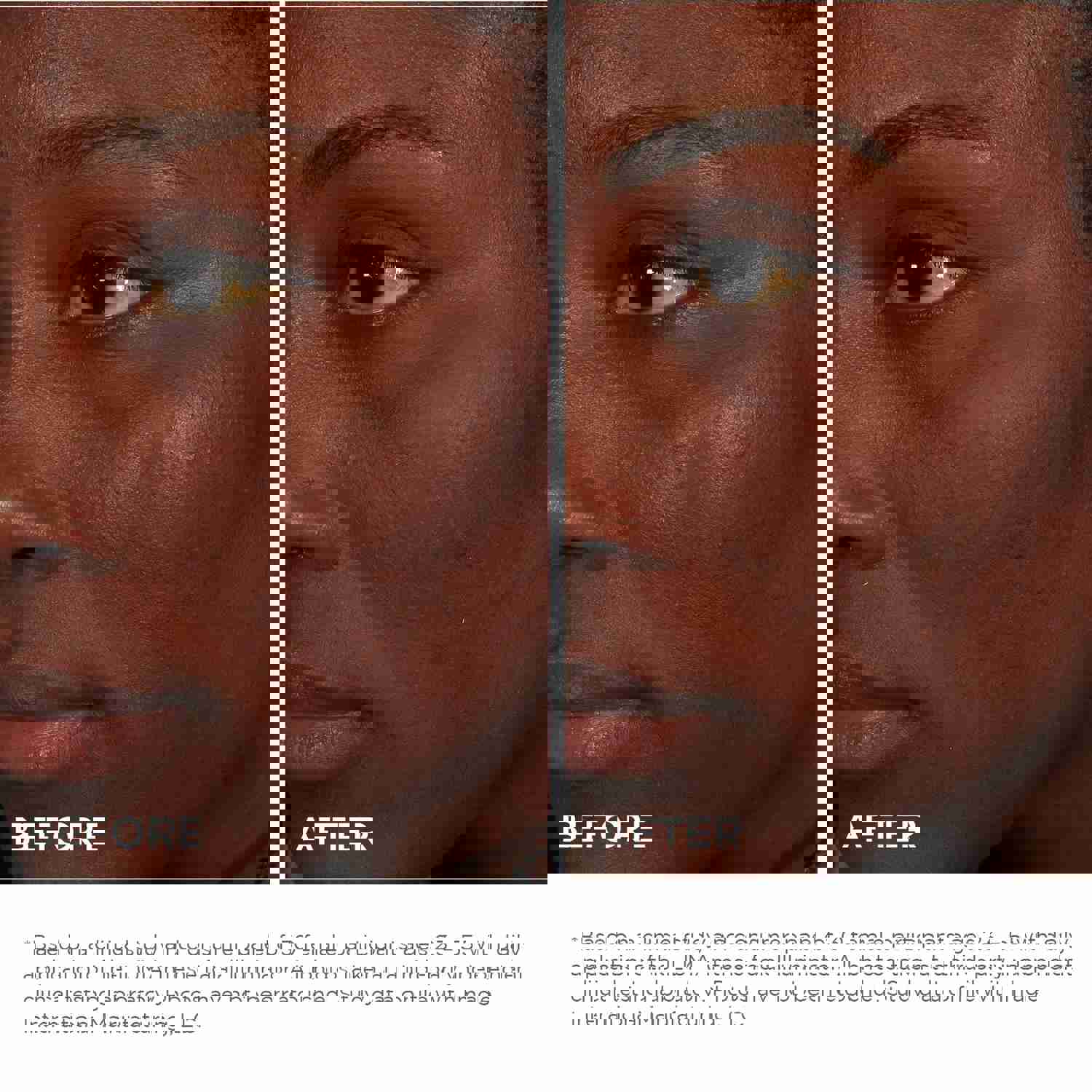 IMAGE Skincare ILUMA Intense Facial Illuminator - Brightening Serum for Dull Skin