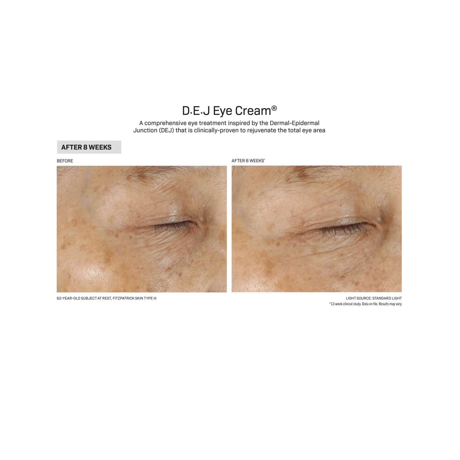 Revision Skincare D.E.J Eye Cream - Comprehensive Eye Treatment