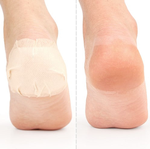 PRRETI Baby Foot Heel Patch - 10 Sheets for Smooth Exfoliating Care