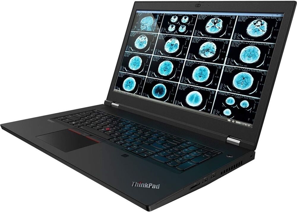 17.3 Lenovo Gaming Laptop: Intel i7 Eight Core, 16GB RAM, 1TB SSD, Nvidia T1000